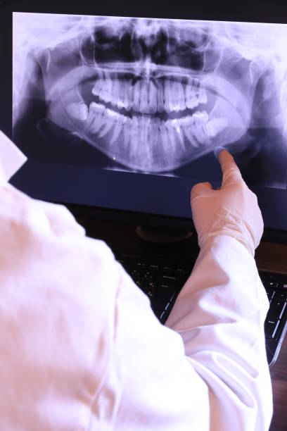 Best Broken or Cracked Tooth Emergency Dentist in Rochester, WA